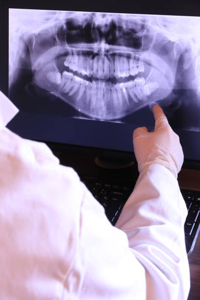 Best Emergency Root Canal Therapy in Mabton, WA