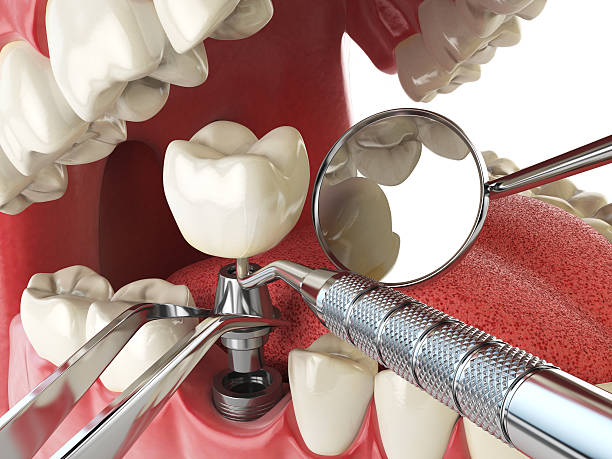 Best Emergency Treatment for Jaw Pain or Injury in Mabton, WA